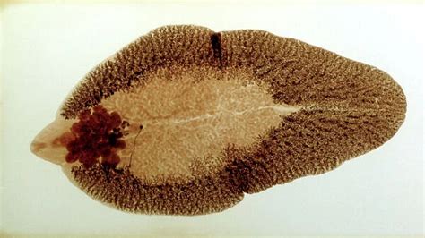  Japanesel Liver Fluke:  A Microscopic Mastermind Manipulating Molluscs!