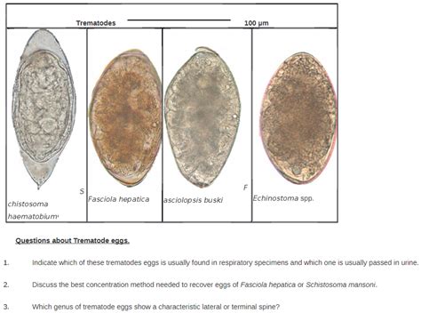  Opisthorchis! A Trematode That Thrives Where Humans Dwell